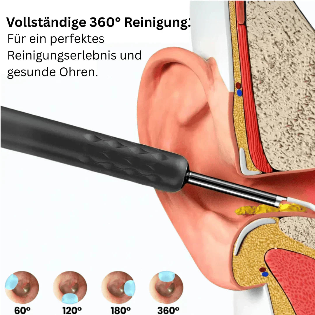 ⏳Begrenzte Zeit 50% Rabatt💥Intelligenter wasserdichter visueller Ohrenschmalzentferner