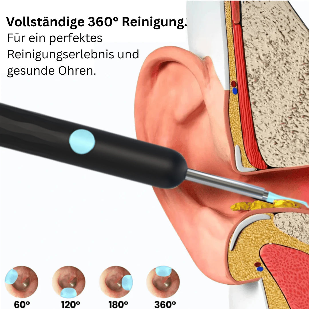 💥Intelligenter wasserdichter visueller Ohrenschmalzentferner👂