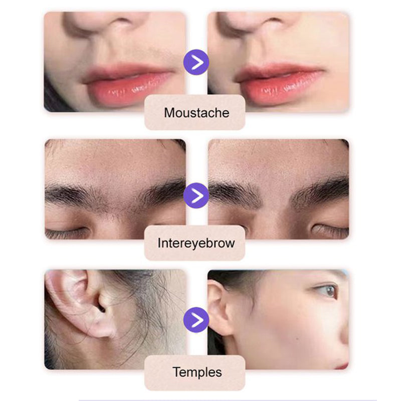 🌸💐Sanfte & schmerzfreie Creme zur Haarentfernung im Gesicht